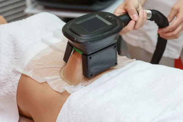 Image of person having fat freezing treatment to help weight gain Clifton