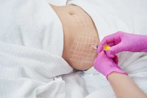 image of fat dissolving injections on love handles to help combat weight gain Clifton